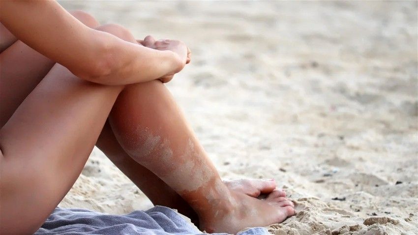 La Calabria ha la sua prima spiaggia naturista autorizzata